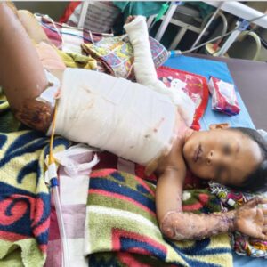 💔“Mumma… mujhe ghar jaana hai…” — whispered little Devansh, his body wrapped in bandages